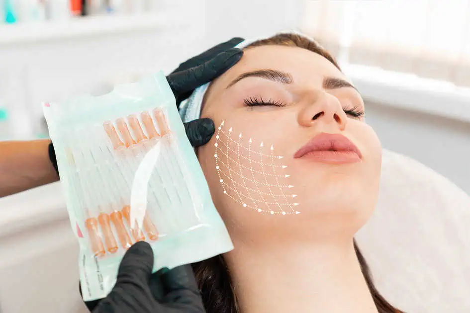 PDO Thread Lifts by Fresh Face Aesthetics in Meridian, ID