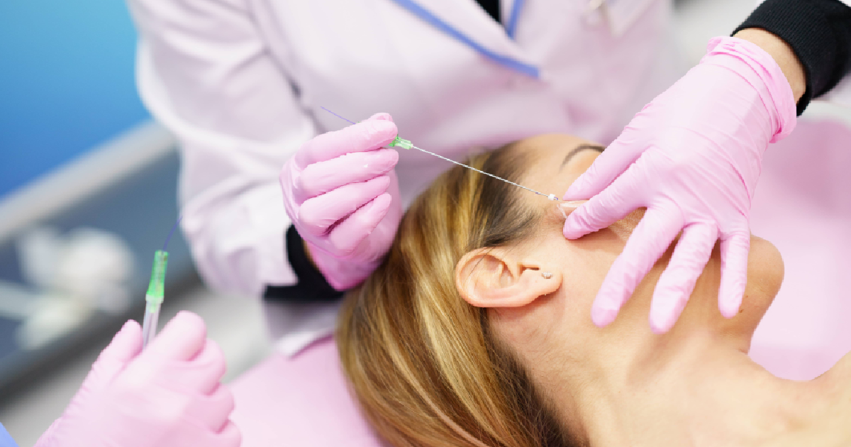 Medical professional performing a PDO Thread Lift in Meridian, ID, on a woman’s face using fine threads.